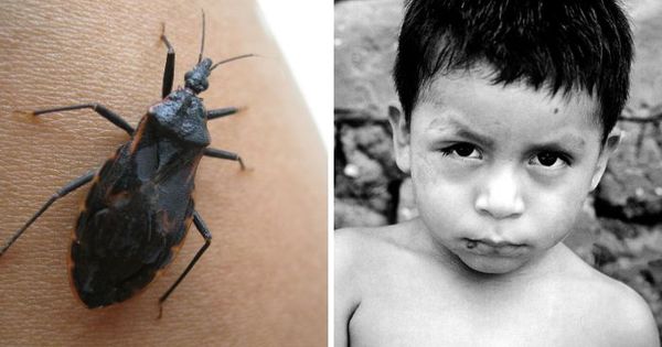 These Deadly Bugs Come Out At Nighttime, And Attacking Victims, They Silently Kill Or Leave Them With A Lifelong Infection